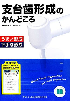 支台歯形成のかんどころ うまい形成下手な形成