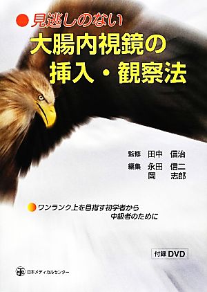 見逃しのない大腸内視鏡の挿入・観察法