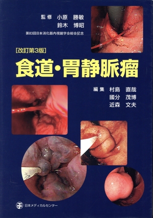 医師と内視鏡技師のコラボによる腹部用手圧迫を用いた大腸内視鏡 中古