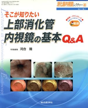 そこが知りたい上部消化管内視鏡の基本Q&A