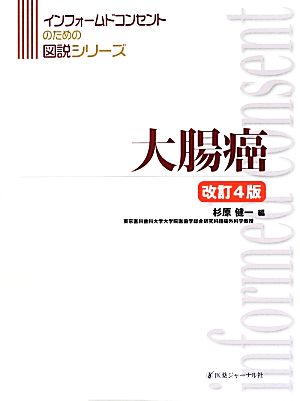 大腸癌 インフォームドコンセントのための図説シリーズ