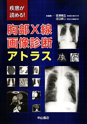 疾患が読める！胸部X線画像診断アトラス疾患が読める！