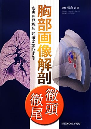 胸部画像解剖徹頭徹尾 疾患を見極め的確に診断する