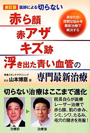 医師による切らない「赤ら顔・赤アザ・キズ跡・浮き出た青い血管」の専門最新治療 あなたの深刻な悩みを最新治療で解決する