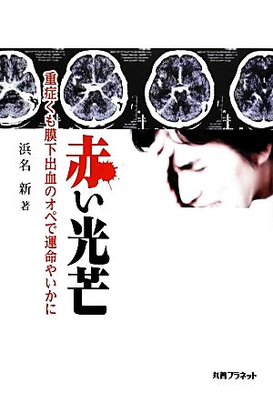 赤い光芒 重症くも膜下出血のオペで運命やいかに