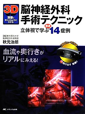 3D画像で手にとるようにわかる脳神経外科手術テクニック 血流や奥行きがリアルにみえる！立体視で学ぶ厳選14症例
