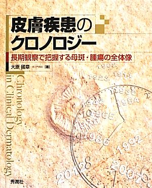 皮膚疾患のクロノロジー 長期観察で把握する母斑・腫瘍の全体像