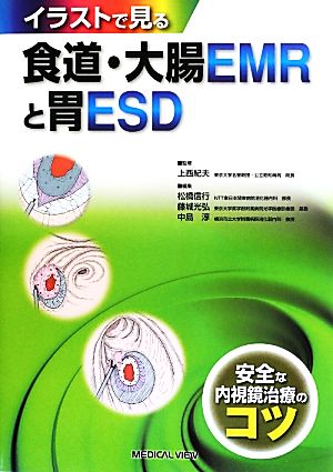 イラストで見る食道・大腸EMRと胃ESD 安全な内視鏡治療のコツ