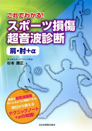 これでわかる！スポーツ損傷超音波診断 肩・肘+α