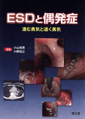 ESDと偶発症 進む勇気と退く勇気