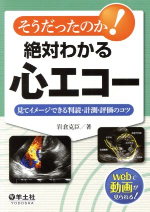 そうだったのか！絶対わかる心エコー 見てイメージできる判読・計測・評価のコツ