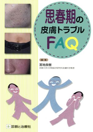 思春期の皮膚トラブルFAQ