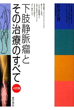 下肢静脈瘤とその治療のすべて