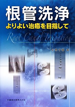 根管洗浄 よりよい治癒を目指して