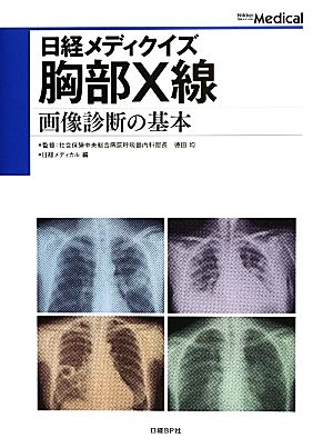 胸部X線 画像診断の基本 日経メディクイズ