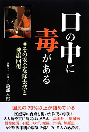 口の中に毒がある その安全な除去法と健康回復