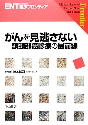 がんを見逃さない 頭頸部癌診療の最前線 ENT臨床フロンティア