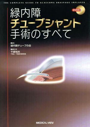 緑内障チューブシャント手術のすべて