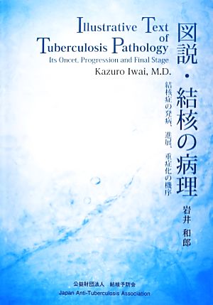 図説・結核の病理 結核症の発病、進展、重症化の機序