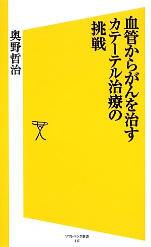 血管からがんを治すカテーテル治療の挑戦 SB新書