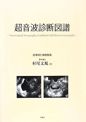 超音波診断図譜 Transvaginal Sonography,Combined with Hysterosonography