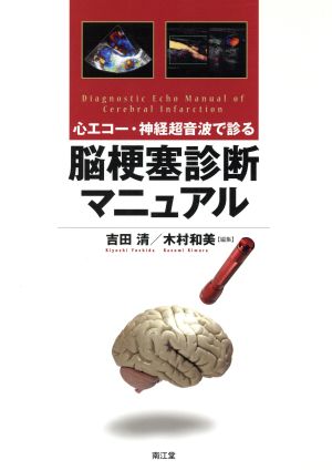 心エコー・神経超音波で診る脳梗塞診断マニュアル