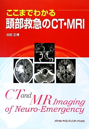 ここまでわかる頭部救急のCT・MRI