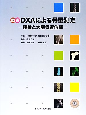 図説 DXAによる骨量測定 腰椎と大腿骨近位部