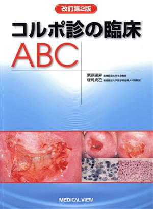 コルポ診の臨床ABC 改訂第2版