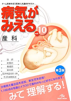 病気がみえる 産科 第3版(vol.10)