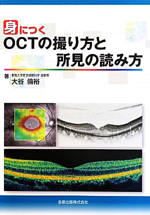 身につくOCTの撮り方と所見の読み方