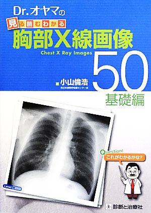 Dr.オヤマの見る読むわかる胸部X線画像50 基礎編