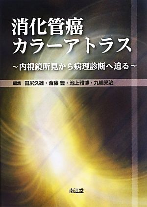 消化管癌カラーアトラス 内視鏡所見から病理診断へ迫る