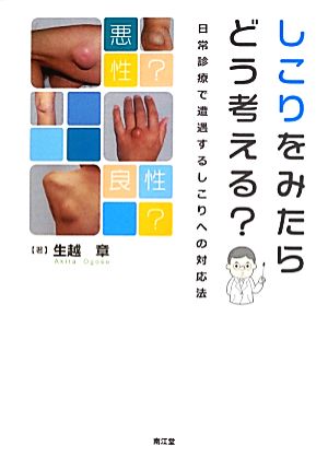 しこりをみたらどう考える？ 日常診療で遭遇するしこりへの対応法