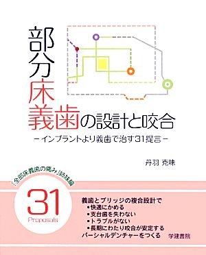 部分床義歯の設計と咬合 インプラントより義歯で治す31提言