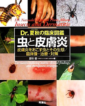 Dr.夏秋の臨床図鑑 虫と皮膚炎 皮膚炎をおこす虫とその生態/臨床像・治療・対策