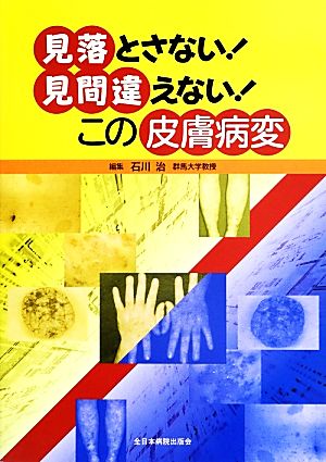 見落とさない！見間違えない！この皮膚病変