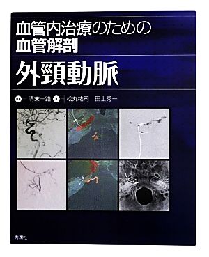 血管内治療のための血管解剖 外頸動脈