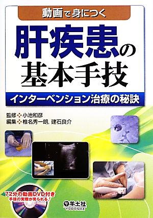 動画で身につく肝疾患の基本手技 インターベンション治療の秘訣