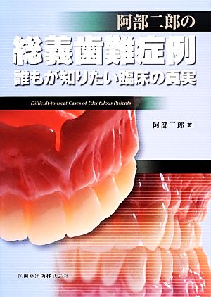 阿部二郎の総義歯難症例 誰もが知りたい臨床の真実