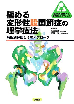 極める変形性股関節症の理学療法 病期別評価とそのアプローチ 臨床思考を踏まえる理学療法プラクティス