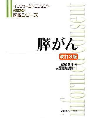 膵がん インフォームドコンセントのための図説シリーズ