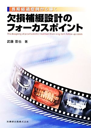 長期経過症例から導く欠損補綴設計のフォーカスポイント