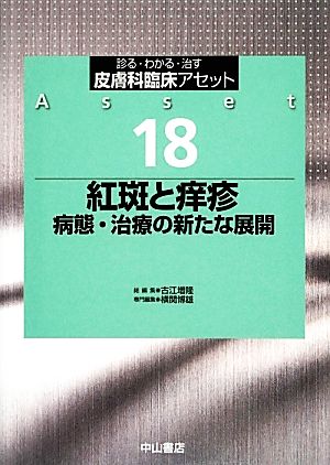 紅斑と痒疹 病態・治療の新たな展開 診る・わかる・治す 皮膚科臨床アセット18