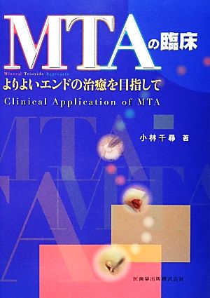 MTAの臨床 よりよいエンドの治癒を目指して