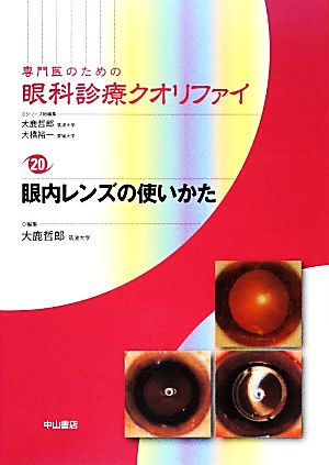 専門医のための眼科診療クオリファイ(20) 眼内レンズの使いかた