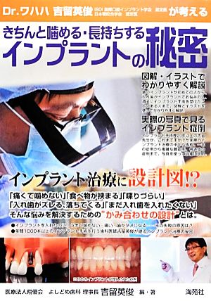 Dr.ワハハ吉留英俊が考えるきちんと噛める・長持ちするインプラントの秘密