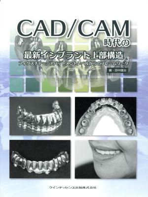 CAD/CAM時代の最新インプラント上部構造