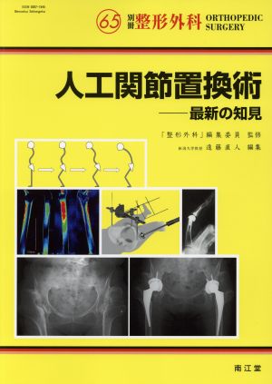 人工関節置換術 最新の知見