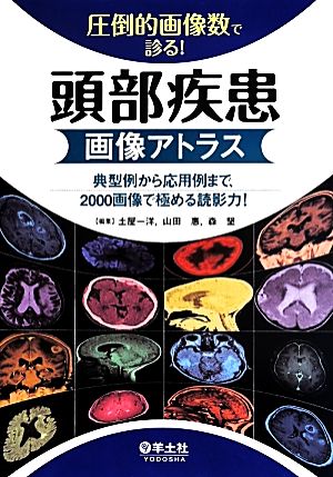 圧倒的画像数で診る！頭部疾患画像アトラス 典型例から応用例まで、2000画像で極める読影力！